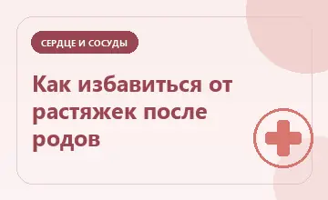 Тематическая иллюстрация: Как избавиться от растяжек после родов