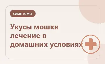 Тематическая иллюстрация: Укусы мошки лечение в домашних условиях