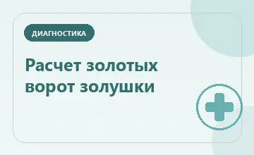 Тематическая иллюстрация: Расчет золотых ворот золушки