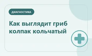 Тематическая иллюстрация: Как выглядит гриб колпак кольчатый