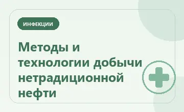 Тематическая иллюстрация: Методы и технологии добычи нетрадиционной нефти