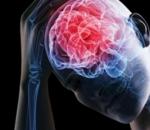 Первые признаки что человек сходит с ума